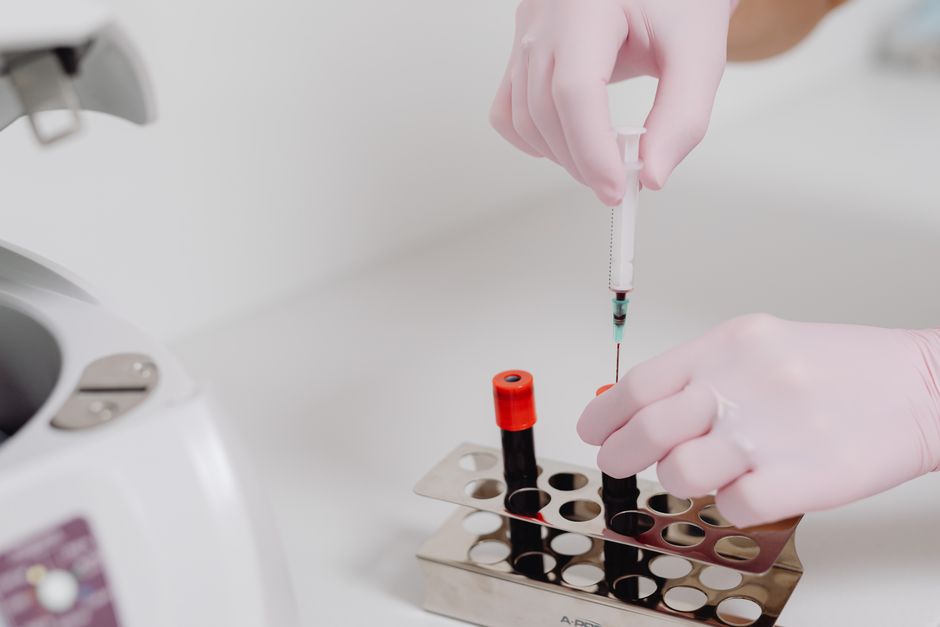How to Interpret Your Own Blood Work: A Step-by-Step Guide for Men Over 50