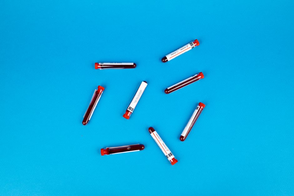 How to Read Your Own Bloodwork at 50+: An Insider’s Decoder for Total T, ApoB, HbA1c, hsCRP, and SHBG